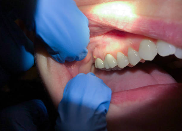 Best Holiday Emergency Dentist in Shreve, OH
